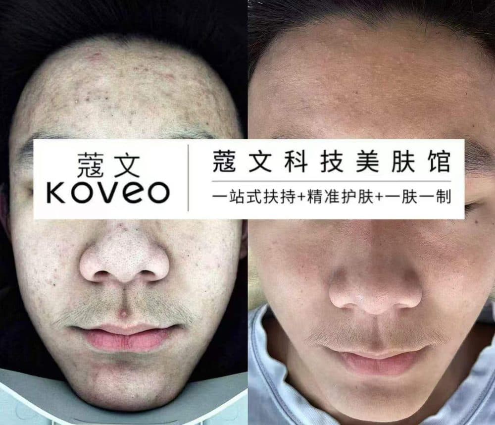 Фотография до и после ухода 6