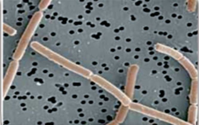 Lactobacillus gasseri TM13 под электронным микроскопом